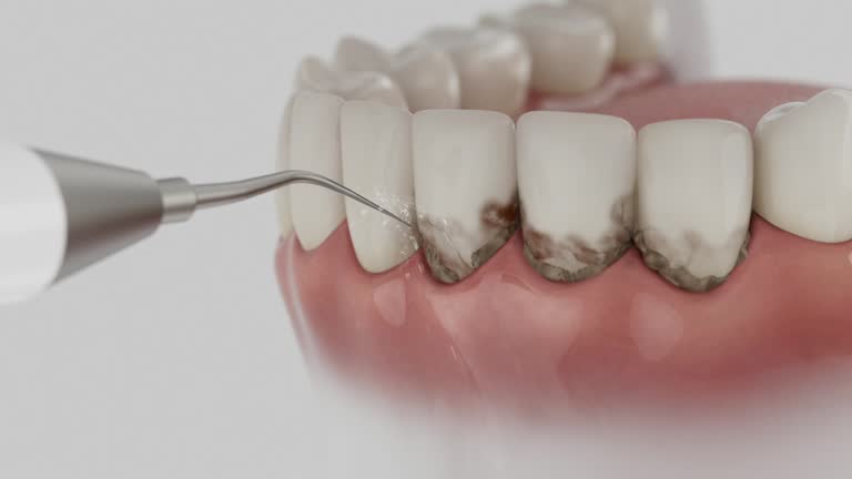Reliable Dental Implants contractor in North Highlands, CA by Smile Center Dentistry